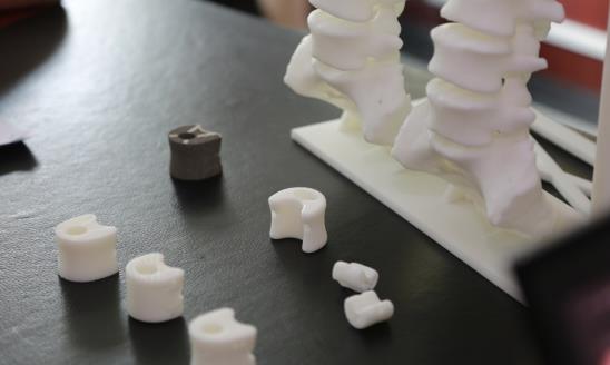 仿生骨行業(yè)發(fā)展現(xiàn)狀及前景研究