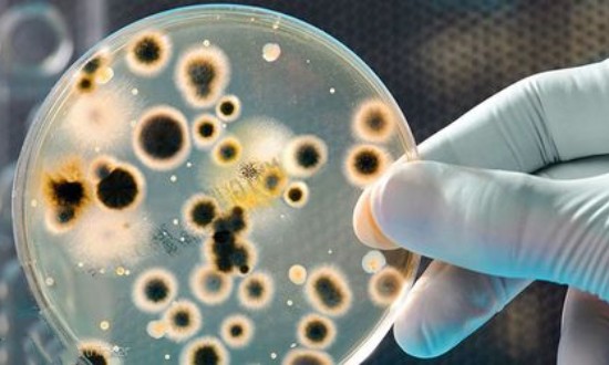2024年中國微生物技術(shù)行業(yè)的產(chǎn)業(yè)鏈結(jié)構(gòu)及投資機會分析